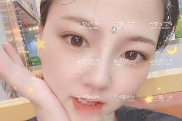 上海生命樹醫(yī)療美容醫(yī)院怎么樣？鼻部手術(shù)價目表和醫(yī)生推薦