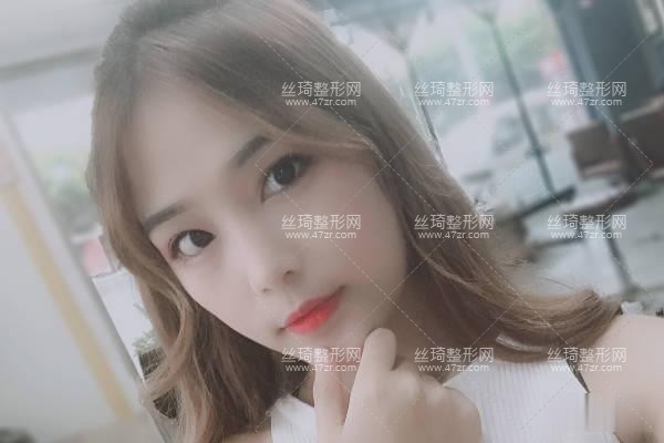 武漢亞太整形隆鼻實拍案例圖價格費醫(yī)生口碑