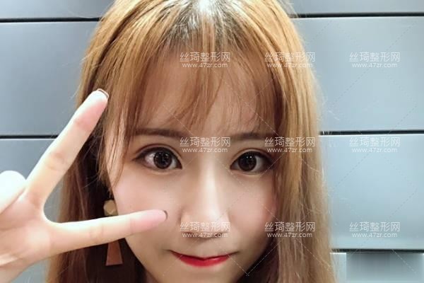 衡陽附一美容科隆鼻怎么樣附手術(shù)介紹專家口碑點評