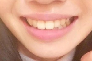 九院正畸科好不好？醫(yī)生名單&2021價(jià)格表