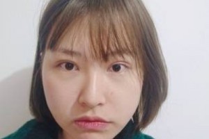 麗港醫(yī)療美容整形醫(yī)院怎么樣？醫(yī)生推薦