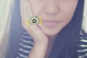 梅州人民醫(yī)院整形科激光嫩膚如何？術后測評-費用表