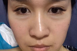 安醫(yī)醫(yī)院隆鼻價(jià)目表|醫(yī)院|醫(yī)生介紹