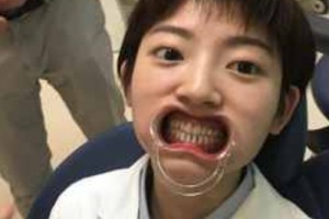 可恩口腔醫(yī)院靠譜嗎？美白牙齒項(xiàng)目測(cè)評(píng)