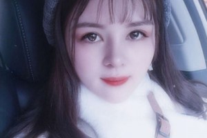 北京協(xié)和醫(yī)院整形外科價格？假體隆鼻術(shù)后恢復(fù)！