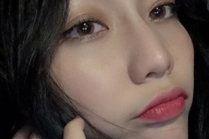 米格醫(yī)療美容醫(yī)院假體隆鼻果？案例+價格表