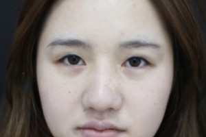 301整形科好不好？醫(yī)院介紹+2021超全價格表