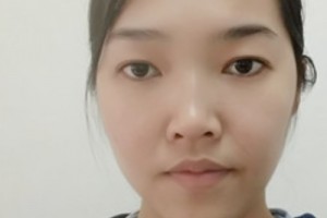 廣州新生毛發(fā)醫(yī)院植發(fā)怎么樣？靠譜嗎？2021價(jià)格表