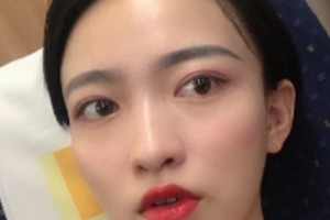 惠州中心醫(yī)院整形美容祛斑果？術(shù)后注意事項(xiàng)必看