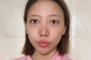 廣州善伊整形口碑如何？醫(yī)生名單+較新費用表優(yōu)惠