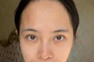 上海九院整形科植發(fā)？掛號難不難網(wǎng)上掛號攻略