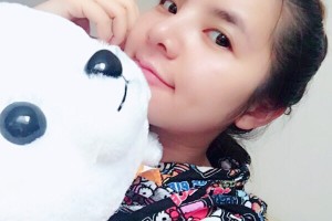 新橋醫(yī)院美容科隆鼻果如何？附術后圖+價格表