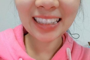 長沙市口腔醫(yī)院牙齒矯正多少錢？案例測評+價格表