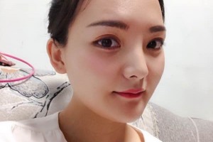 鄭大一附院整形科/下頜角案例果&價(jià)格表