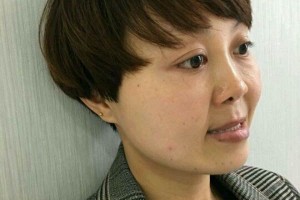 東莞健力口腔｜牙齒矯正術后反饋+醫(yī)生介紹