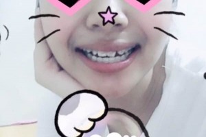 青島可恩口腔醫(yī)院牙齒矯正靠譜嗎？圖片對(duì)比+價(jià)格表