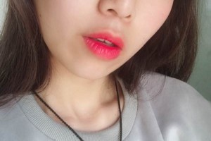 鄭大一附院整形科|雙眼皮術(shù)后恢復(fù)+醫(yī)生介紹