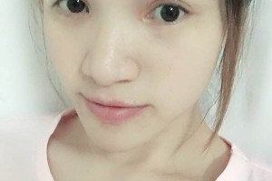 上海千美整形醫(yī)院\術后案例必看