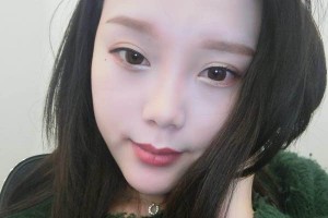 河南省人民醫(yī)院雙眼皮成功案例在線分享！