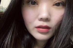 合肥禾麗整形醫(yī)院雙眼皮到底好不好？真實案例測評~