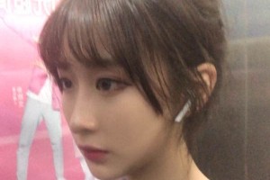 鄭州第一附院整形科靠譜嗎？下頜角真實(shí)案例圖