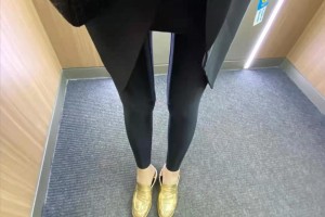 寧波六院整形科溶脂瘦身果如何？附案例圖速看！