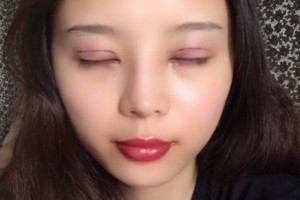 西安星伊美醫(yī)療整形怎么樣？附醫(yī)院簡(jiǎn)介+雙眼皮日記