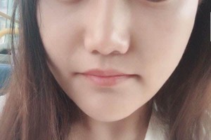 重慶原辰醫(yī)療美容醫(yī)院下頜角怎么樣？醫(yī)生信息介紹