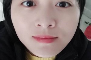 江蘇蘇州薇琳醫(yī)院正規(guī)嗎？下頜角術(shù)后果+價格表