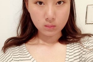 北京協(xié)和醫(yī)院整形外科下頜角醫(yī)生詳細介紹附價格表推薦！