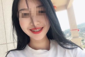 深圳福華口腔是正規(guī)醫(yī)院？牙齒矯正術(shù)案例|醫(yī)生口碑