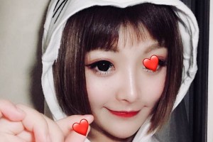 河南省人民醫(yī)院埋線雙眼皮/術(shù)前術(shù)后果對(duì)比！