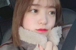 昆明延安醫(yī)院埋線雙眼皮正規(guī)嗎？術(shù)后案例實(shí)拍分享！