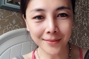 鄭州華領(lǐng)整形醫(yī)院硅膠隆鼻評(píng)價(jià)/術(shù)前術(shù)后果對(duì)比！