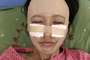 上海安縵醫(yī)療怎么樣？面部填充成功案例測評！