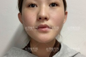 上海安縵醫(yī)療美容怎么樣？熱瑪吉反饋|醫(yī)生介紹