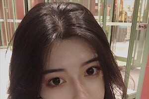 廈門新生毛發(fā)醫(yī)院是正規(guī)嗎？植發(fā)案例+醫(yī)院介紹