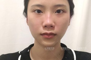 杭州浙一醫(yī)院有做熱瑪吉嗎？附果圖+價格表