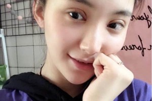 上海千美醫(yī)療美容院定點雙眼皮？術(shù)后術(shù)前明X果～