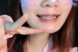 長沙中諾口腔醫(yī)院/牙齒矯正圖片對比！