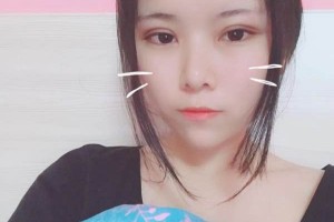 貴州省二醫(yī)整形科項目？定點雙眼皮案例測評