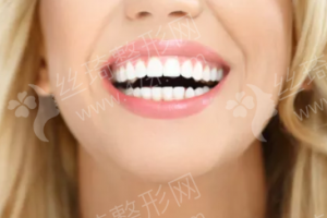 無(wú)錫做牙齒美白機(jī)構(gòu)排行榜醫(yī)院信息|牙齒美白體驗(yàn)日記分享!醫(yī)院優(yōu)勢(shì)簡(jiǎn)介