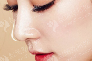 安康做隆鼻醫(yī)院排行榜隆鼻術(shù)后體驗感受分享，隆鼻項目術(shù)后案例細節(jié)點評，醫(yī)院優(yōu)勢簡介