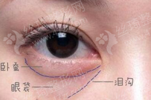 咸陽做射頻緊膚機構(gòu)排名射頻緊膚案例過程分享,射頻緊膚項目術(shù)后體驗日記點評-醫(yī)院實力簡介