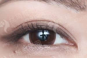 泰安做開眼角醫(yī)院排名開眼角項目術(shù)后體驗記錄點評,醫(yī)院優(yōu)勢介紹!醫(yī)院優(yōu)勢盤點