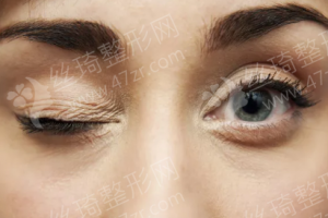 烏魯木齊做近視眼手術(shù)機構(gòu)排名醫(yī)院實力盤點_醫(yī)院優(yōu)勢簡介-近視眼手術(shù)項目案例記錄點評