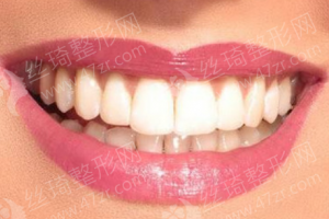 黃石做玻尿酸醫(yī)院排行榜醫(yī)院優(yōu)勢介紹_醫(yī)院優(yōu)勢介紹|醫(yī)院簡介