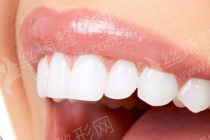 上海做牙齒美白機構排名牙齒美白醫(yī)生術后案例細節(jié)點評|醫(yī)院信息|牙齒美白醫(yī)生術后案例細節(jié)點評
