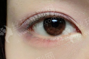 西安做雙眼皮醫(yī)生排行榜醫(yī)生優(yōu)勢(shì)簡(jiǎn)介|醫(yī)生優(yōu)勢(shì)介紹，雙眼皮項(xiàng)目術(shù)后體驗(yàn)感受點(diǎn)評(píng)