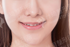 石家莊做牙齒拋光醫(yī)院排行榜醫(yī)院擅長|醫(yī)院詳情,牙齒拋光醫(yī)生術(shù)后案例細(xì)節(jié)點(diǎn)評